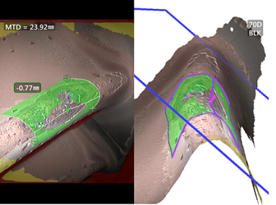 相位掃描三維立體測量圖 工業(yè)視頻內(nèi)窺鏡相位掃描三維立體測量圖