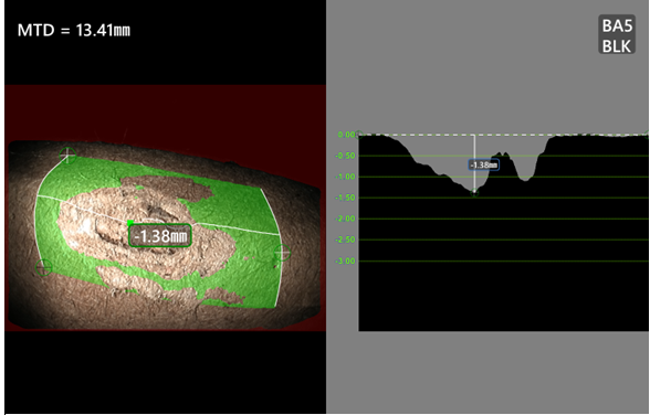 韋林視頻內(nèi)窺鏡深度剖面測(cè)量示意圖 韋林視頻內(nèi)窺鏡深度剖面測(cè)量示意圖